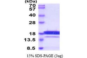 Chemerin Protein (AA 21-157) (His tag)