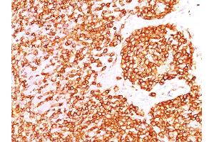 Formalin-fixed, paraffin-embedded human Tonsil stained with CD45 Mouse Recombinant Monoclonal Antibody (rPTPRC/1460). (Rekombinanter CD45 Antikörper)