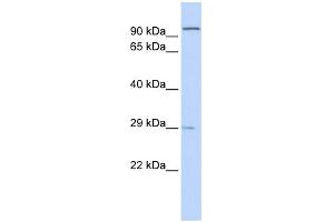 WB Suggested Anti-SSPN Antibody Titration:  0. (SSPN Antikörper  (Middle Region))