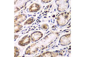 Immunohistochemistry (Paraffin-embedded Sections) (IHC (p)) image for anti-Ribophorin 1 (RPN1) (AA 20-280) antibody (ABIN6147170)