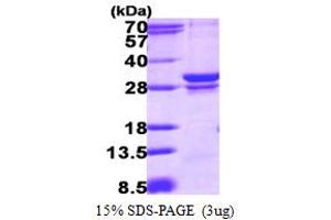 SDS-PAGE (SDS) image for RAB23, Member RAS Oncogene Family (RAB23) (AA 1-234) protein (His tag) (ABIN667606)