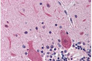 Human Brain, Cerebellum (formalin-fixed, paraffin-embedded) stained with RRM2B antibody ABIN214469 at 2. (RRM2B Antikörper  (AA 2-17))