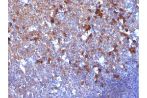 Formalin-fixed, paraffin-embedded human Tonsil stained with IgG Monoclonal Antibody (IG217) (IGHG Antikörper)