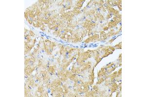 Immunohistochemistry of paraffin-embedded mouse heart using TP53I11 antibody (ABIN6131365, ABIN6149418, ABIN6149419 and ABIN6216636) at dilution of 1:100 (40x lens). (TP53I11 Antikörper  (AA 1-70))