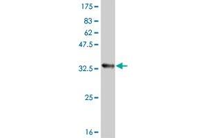 Western Blot detection against Immunogen (33. (ATOX1 Antikörper  (AA 1-68))