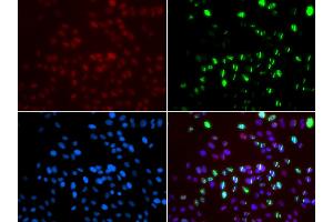 Immunofluorescence analysis of GFP-RNF168 transgenic U2OS cells using MSH6 antibody (ABIN5971626). (MSH6 Antikörper)