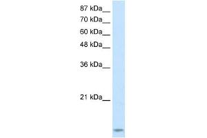 TARBP2 antibody used at 2.