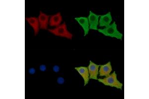 ABIN7096169 and ABIN7100231 staining HepG2 cells by IF/ICC. (RASAL1 Antikörper)