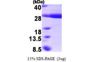 SDS-PAGE (SDS) image for Heat Shock 22kDa Protein 8 (HSPB8) (AA 1-196) protein (His tag) (ABIN667769) (HSPB8 Protein (AA 1-196) (His tag))