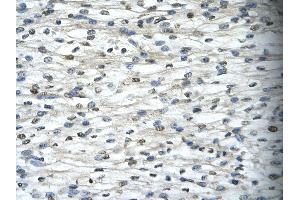 Immunohistochemistry (IHC) image for anti-TAF15 RNA Polymerase II, TATA Box Binding Protein (TBP)-Associated Factor, 68kDa (TAF15) (N-Term) antibody (ABIN2779283)