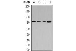 Western blot analysis of Beta-adducin expression in Jurkat (A), HEK293T (B), Raw264. (ADD2 Antikörper)