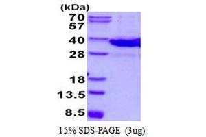 Image no. 1 for Lectin, Galactoside-Binding, Soluble, 8 (LGALS8) (AA 1-316) (Active) protein (His tag) (ABIN1098433)