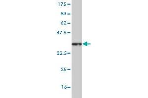 Western Blot detection against Immunogen (36. (HSF4 Antikörper  (AA 121-220))