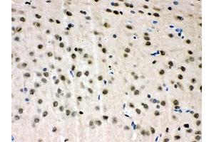 Immunohistochemistry (IHC) image for anti-Valosin Containing Protein (VCP) (AA 732-760) antibody (ABIN3029568)