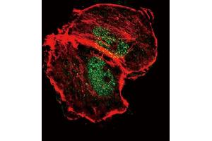 Immunofluorescence (IF) image for anti-Tuberous Sclerosis 2 (TSC2) (pSer664) antibody (ABIN389817)