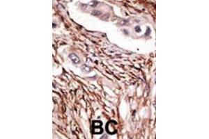 Immunohistochemistry (IHC) image for anti-Notch 3 (NOTCH3) antibody (ABIN3002554) (NOTCH3 Antikörper)