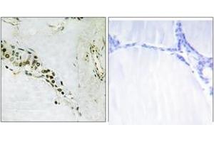 Immunohistochemistry analysis of paraffin-embedded human thyroid gland tissue, using Cyclin E2 (Ab-392) Antibody.