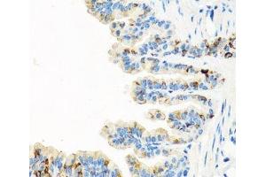 Immunohistochemistry of paraffin-embedded Mouse lung using RGS5 Polyclonal Antibody at dilution of 1:100 (40x lens). (RGS5 Antikörper)