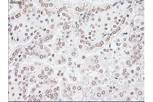 Image no. 2 for anti-Glial Fibrillary Acidic Protein (GFAP) antibody (ABIN1498440)