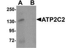 Western blot analysis of ATP2C2 in 3T3 cell lysate with ATP2C2 antibody at 1 μg/ml in (A) the absence and (B) the presence of blocking peptide (ATP2C2 Antikörper  (N-Term))