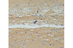 Immunohistochemistry (IHC) image for anti-Interleukin 12 beta (IL12B) (AA 30-311) antibody (ABIN1868574)