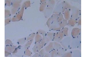 Detection of IkBd in Mouse Skeletal muscle Tissue using Polyclonal Antibody to Inhibitory Subunit Of NF Kappa B Delta (IkBd) (IkBd Antikörper  (AA 58-304))