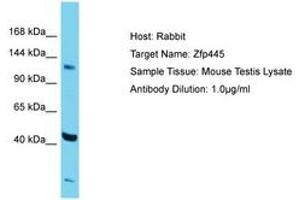 Image no. 1 for anti-Zinc Finger Protein 445 (ZNF445) (AA 406-455) antibody (ABIN6750286) (ZNF445 Antikörper  (AA 406-455))