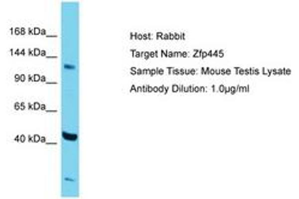 ZNF445 anticorps  (AA 406-455)