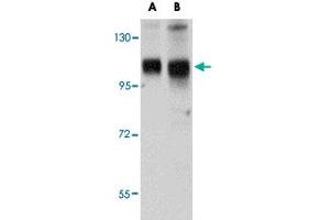 Western blot analysis of SH3BP4 in rat lung tissue lysate with SH3BP4 polyclonal antibody  at (A) 1 and (B) 2 ug/mL . (SH3BP4 Antikörper  (C-Term))