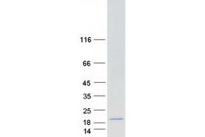 G0S2 Protein (Myc-DYKDDDDK Tag)