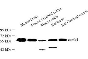 Western blot analysis of camk4 (ABIN7073281) at dilution of 1: 500 (CAMK4 Antikörper)
