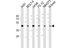 Western Blotting (WB) image for anti-Argininosuccinate Synthase 1 (ASS1) (AA 192-221) antibody (ABIN390810)