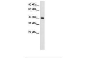 Image no. 1 for anti-Pseudouridylate Synthase 1 (PUS1) (C-Term) antibody (ABIN6736124)
