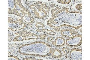 IHC analysis of HSPD1 using anti-HSPD1 antibody (ABIN7600976).
