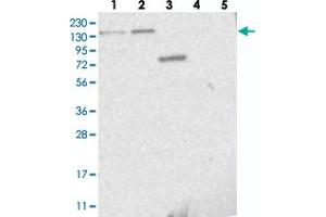 Western blot analysis of Lane 1: RT-4, Lane 2: U-251 MG, Lane 3: Human Plasma, Lane 4: Liver, Lane 5: Tonsil with PPP2R3A polyclonal antibody  at 1:250-1:500 dilution. (PPP2R3A Antikörper)