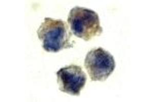 Immunohistochemistry (IHC) image for anti-Interleukin 22 Receptor (IL22R) (N-Term) antibody (ABIN1031411) (IL22R Antikörper  (N-Term))