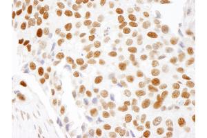 anti-High Mobility Group Nucleosome Binding Domain 1 (HMGN1) (AA 90-100) antibody