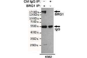 Immunoprecipitation analysis of K562 cell lysates using BRG1 mouse mAb (201025). (SMARCA4 Antikörper)
