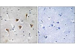 Immunohistochemistry (IHC) image for anti-Mitochondrial Transcription Termination Factor (MTERF) (AA 267-316) antibody (ABIN2890668)