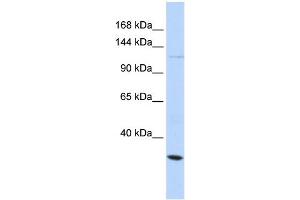 WB Suggested Anti-KCNMA1 Antibody Titration:  0. (KCNMA1 Antikörper  (Middle Region))