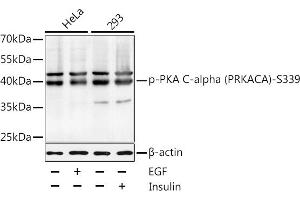 Western blot analysis of extracts of HeLa and 293 cells, using Phospho-PKA C-alpha (PRKACA)-S339 antibody  at 1:1000 dilution.