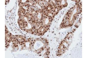 IHC-P Image Immunohistochemical analysis of paraffin-embedded human endo mitral, using PDE4C, antibody at 1:100 dilution.