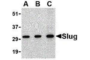 Western Blotting (WB) image for anti-SLUG (Center) antibody (ABIN2476524) (SLUG Antikörper  (Center))