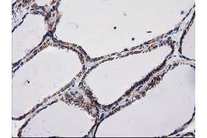 Image no. 1 for anti-Catenin (Cadherin-Associated Protein), beta 1, 88kDa (CTNNB1) antibody (ABIN1496890) (CTNNB1 Antikörper)