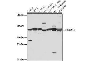 Western blot analysis of extracts of various cell lines, using HOX Rabbit mAb (ABIN7267762) at 1:500 dilution. (HOXA13 Antikörper)