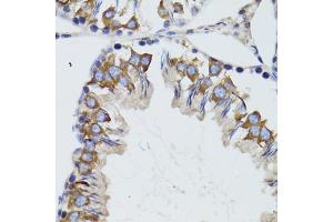 Immunohistochemistry of paraffin-embedded mouse testis using HEXA antibody (ABIN6290114) at dilution of 1:100 (40x lens). (Hexosaminidase A Antikörper)