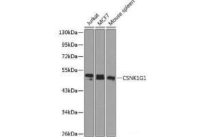 Western blot analysis of extracts of various cell lines using CSNK1G1 Polyclonal Antibody at dilution of 1:1000. (CSNK1G1 Antikörper)