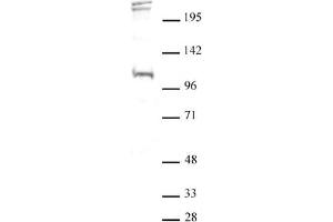 Western blot of BLIMP1 / PRDM1 antibody. (PRDM1 Antikörper  (N-Term))