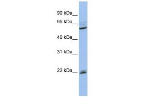 WB Suggested Anti-NR0B1 Antibody Titration: 0.