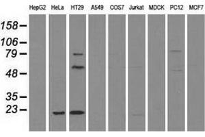 Western blot analysis of extracts (35 µg) from 9 different cell lines by using anti-CD4 monoclonal antibody. (CD4 Antikörper)